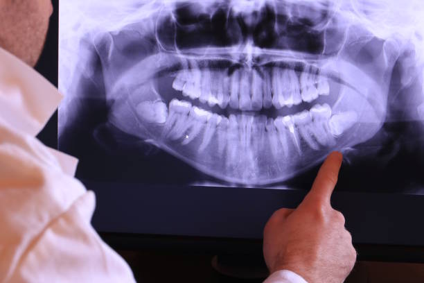 Best Cosmetic Emergency Dentistry in Parole, MD
