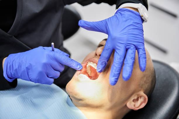 Best Emergency Treatment for Dental Infections or Abscesses in Parole, MD