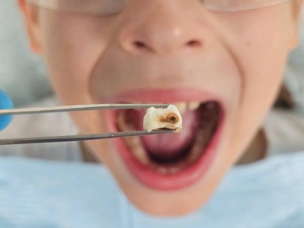Best Pediatric Emergency Dentist in Parole, MD