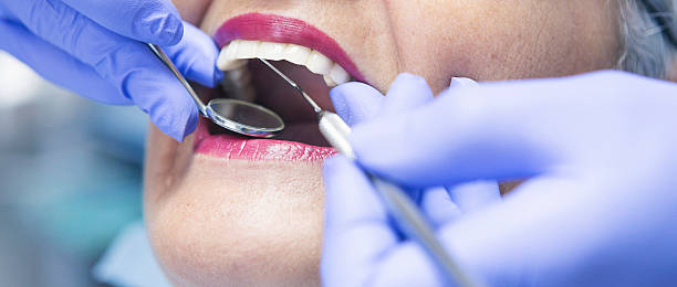 Best Emergency Dental Care for Broken or Chipped Teeth in Parole, MD